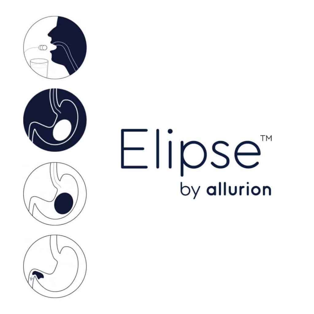 elipse weight loss balloon by allurion