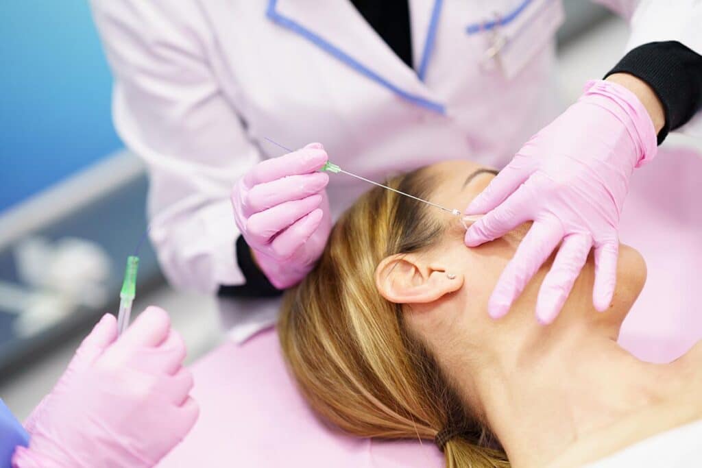 Doctor injecting PDO suture treatment threads into the face of a woman.