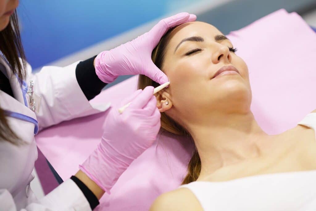 Doctor painting the area of a woman's face where the PDO suture treatment threads will be injected.