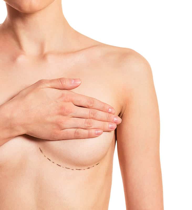 preparation for breast surgery