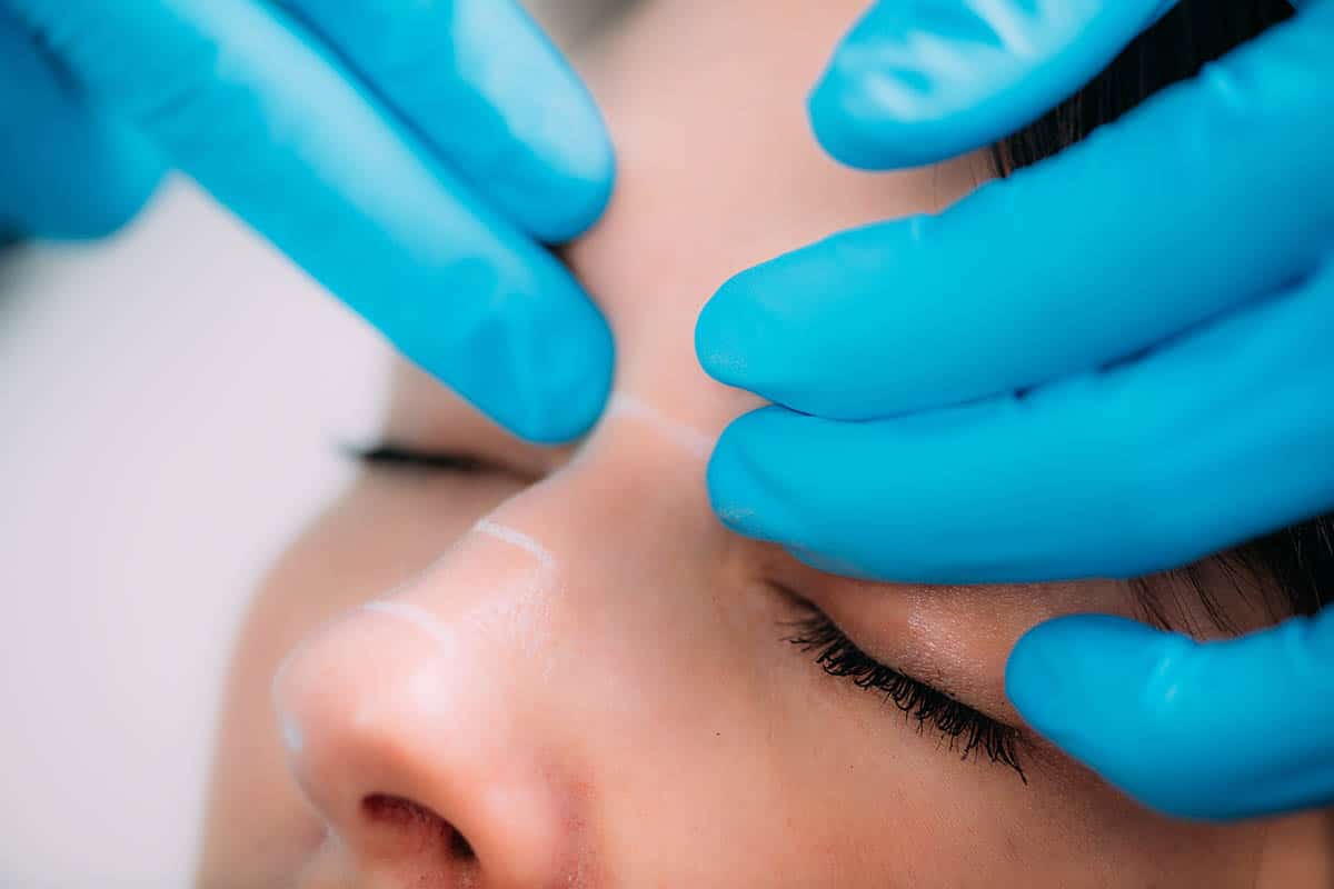 Doctor preparing a dermal filler for treatment of a woman’s nose for nasal hump correction