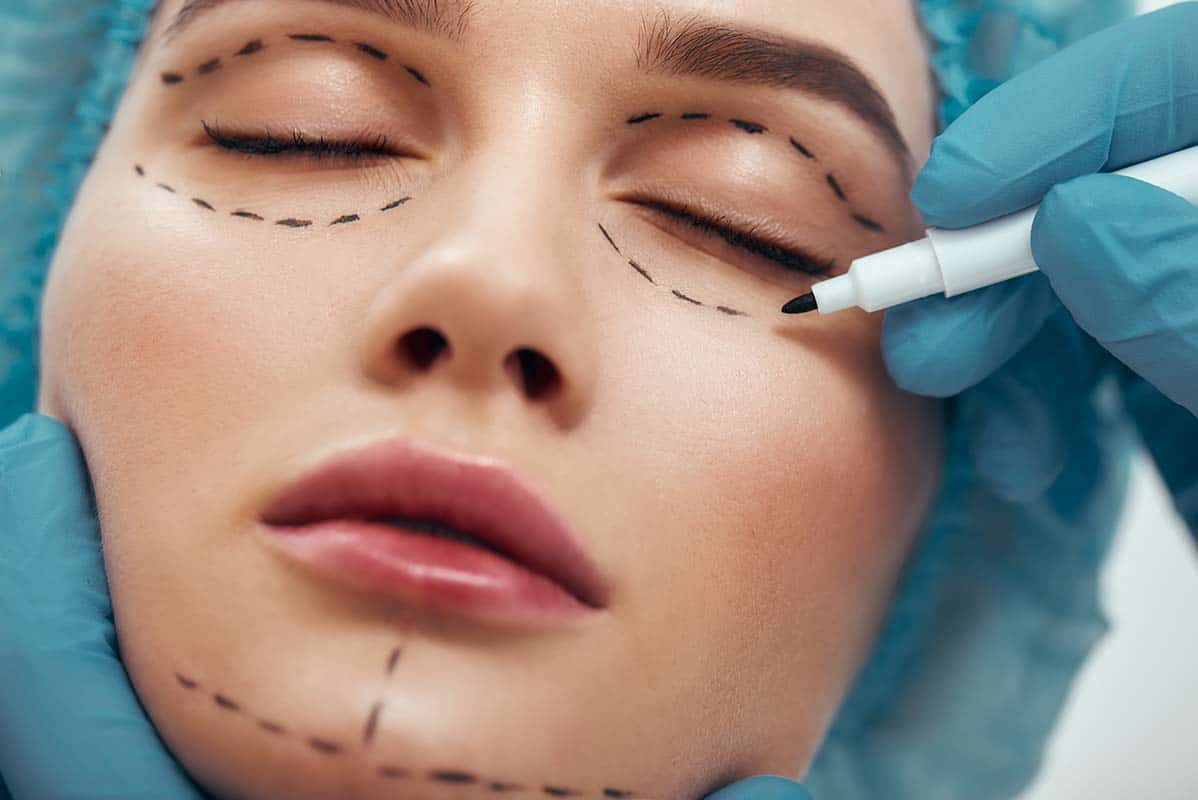 woman being prepared for double eyelid surgery