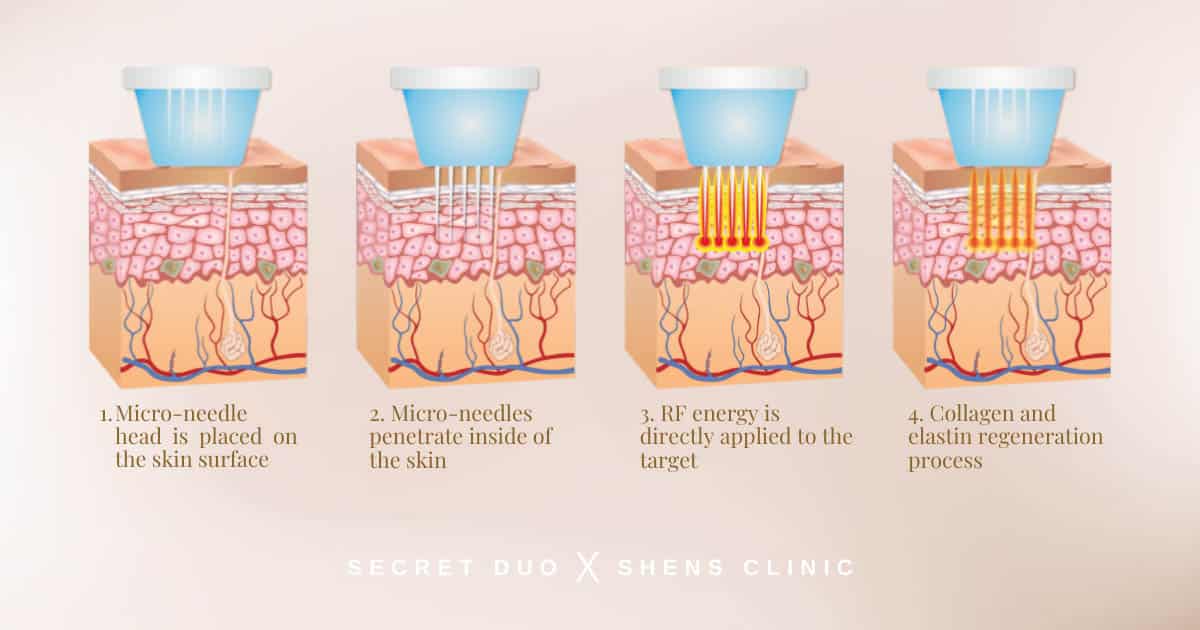 shens clinic's secret due treatment process graph