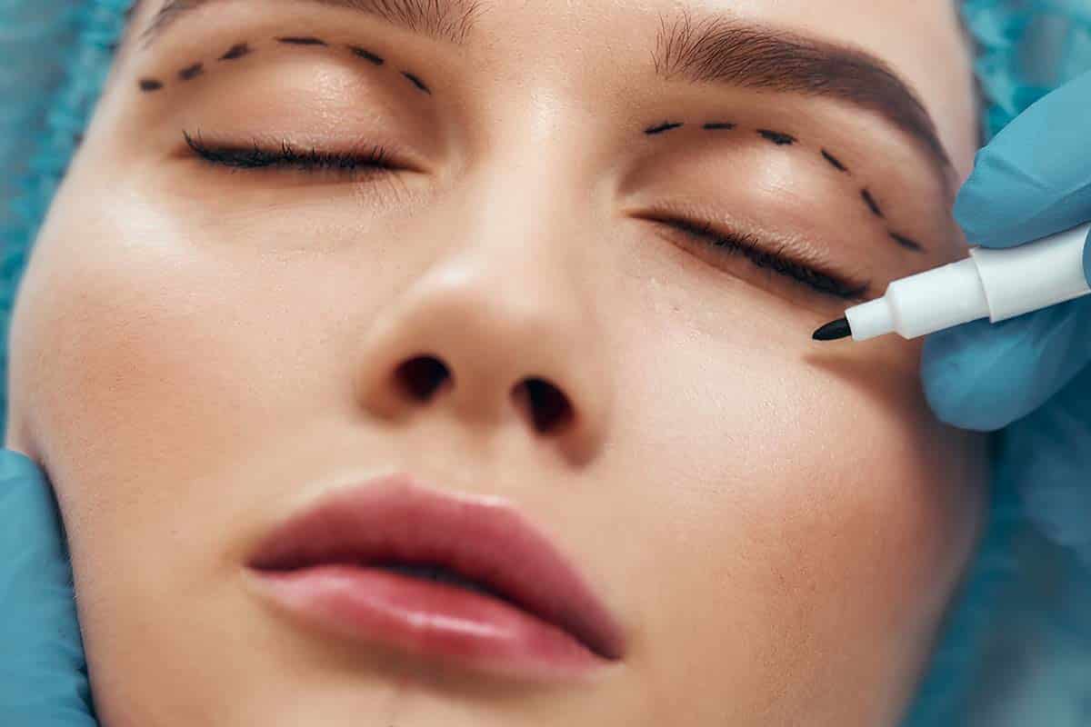 woman preparing for double eyelid surgery in Singapore