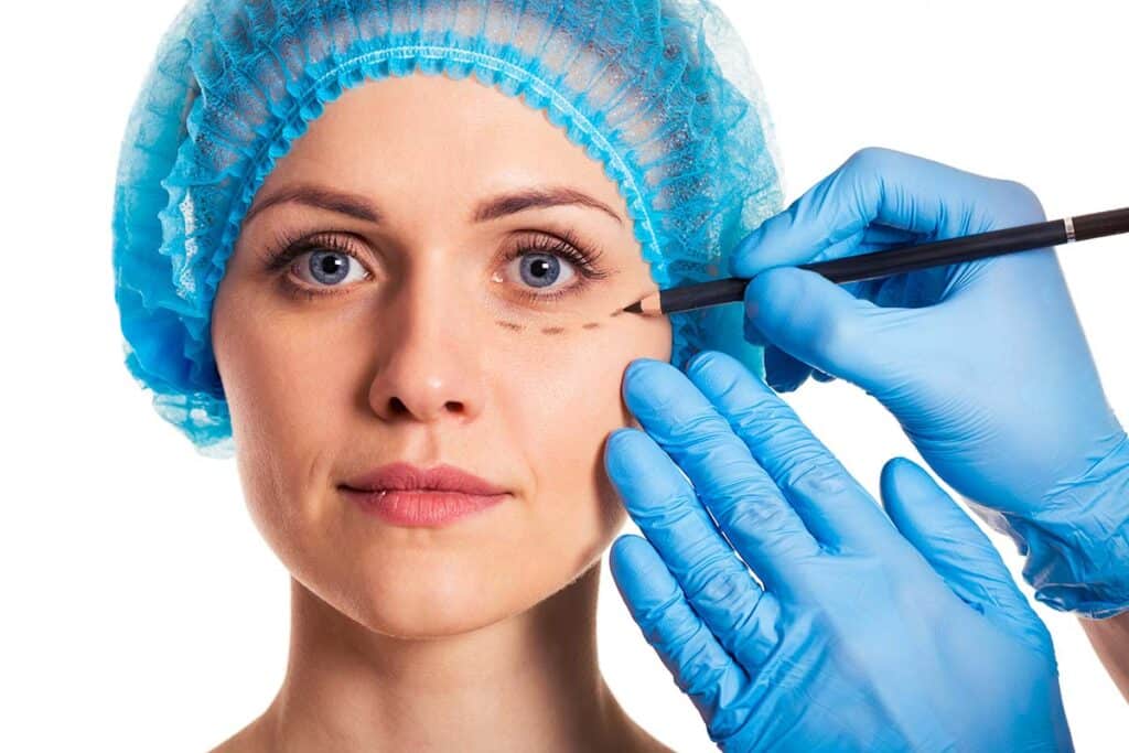 woman preparing for eyelid surgery